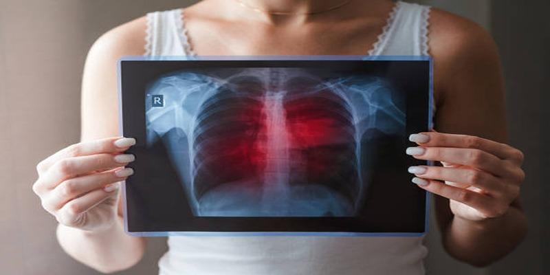 3 Critical Facts About Lung Cancer Screening You Should Know