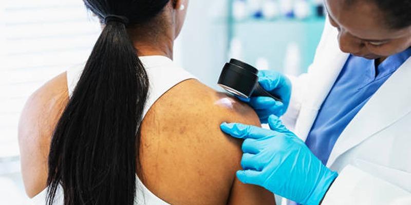 3 Essential Things You Must Know About Melanoma
